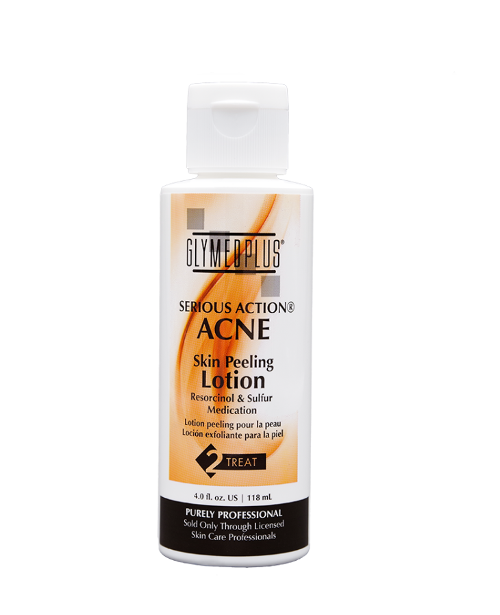 Skin Peeling Lotion Пилинг лосьон с серой и резорцином для лечения проблемной кожи, 118 мл
Skin Peeling Lotion Пилинг лосьон с серой и резорцином для лечения проблемной кожи, 118 мл