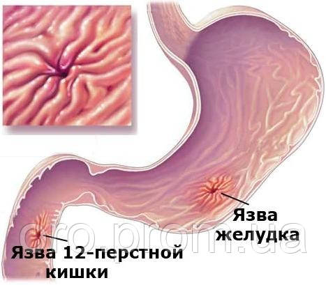 диета для кастрированных котов и диета при гастрите и дисбактериозе