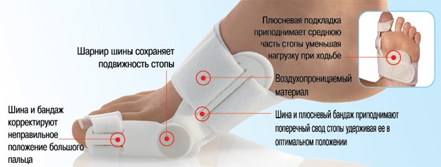 Косточки на ногах лечение причины и симптомы