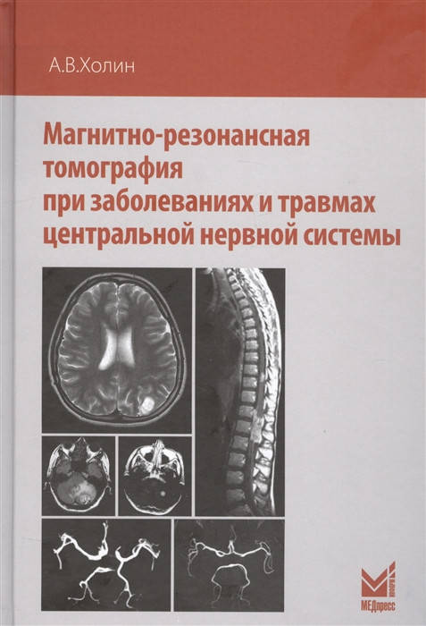 Холин Магнитно-резонансная томография при заболеваниях и травмах центральной нервной системы 2-е изд 2019 год
Холин Магнитно-резонансная томография при заболеваниях и травмах центральной нервной системы 2-е изд 2019 год