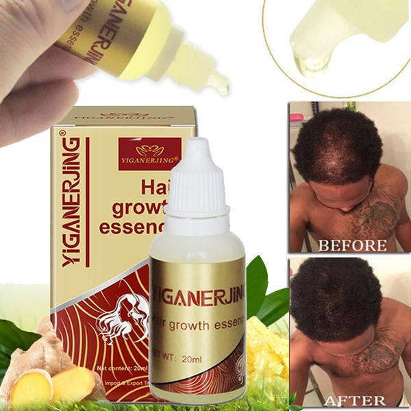 Эссенция масло для роста волос Yiganerjing Hair Growth, 20 мл. Средство от выпадения волос.
Эссенция масло для роста волос Yiganerjing Hair Growth, 20 мл. Средство от выпадения волос.