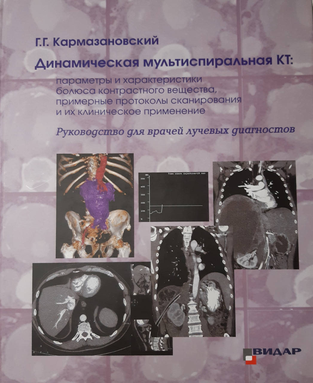 Г.Г. Кармазановский. Динамическая мультиспиральная КТ. Руководство для врачей лучевых диагностов. 2020г
Г.Г. Кармазановский. Динамическая мультиспиральная КТ. Руководство для врачей лучевых диагностов. 2020г