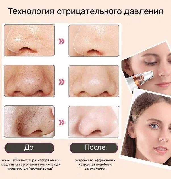 Вакуумный аппарат очиститель кожи и пор Multi-Functional для чистки лица! Рекомендации, Белый
Вакуумный аппарат очиститель кожи и пор Multi-Functional для чистки лица! Рекомендации, Белый