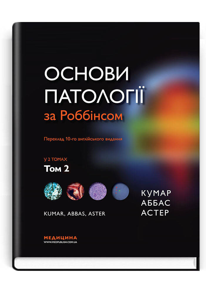 Основи патології за Роббінсом: у 2 томах. Том 2 / Віней Кумар, Абул К. Аббас, Джон К. Астер; 10 те видання.
Основи патології за Роббінсом: у 2 томах. Том 2 / Віней Кумар, Абул К. Аббас, Джон К. Астер; 10 те видання.