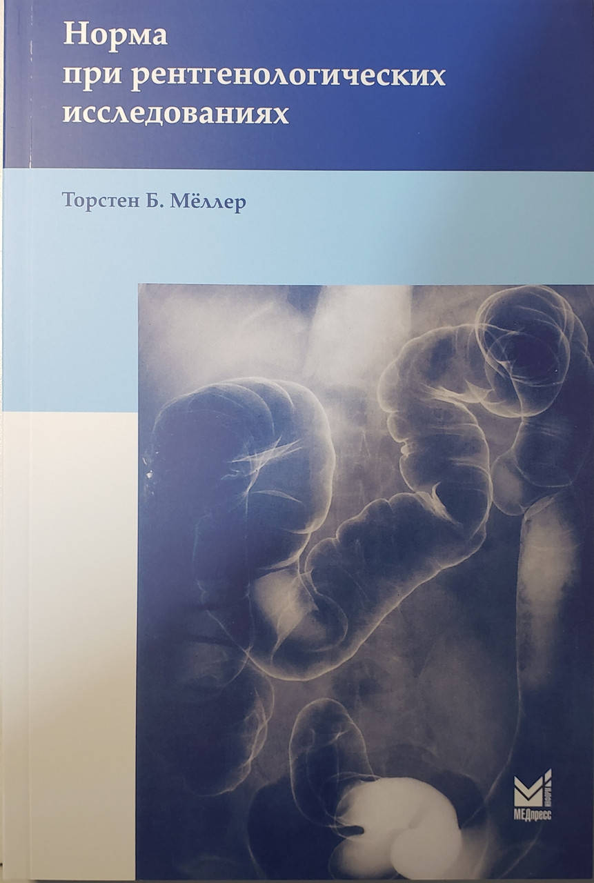 Мёллер Т.Б. Норма при рентгенологических исследованиях 4-е издание 2021 год
Мёллер Т.Б. Норма при рентгенологических исследованиях 4-е издание 2021 год