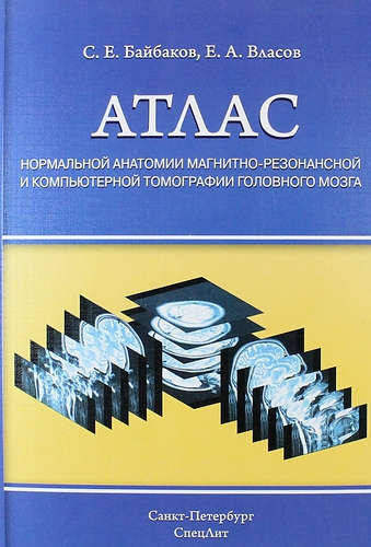 Байбаков С.Е. Атлас нормальной анатомии магнитно-резонансной и компьютерной томографии головного мозга
Байбаков С.Е. Атлас нормальной анатомии магнитно-резонансной и компьютерной томографии головного мозга