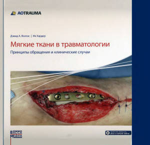 Мягкие ткани в травматологии. Принципы обращения и клинические случаи Волгас Дэвид 2016г.
Мягкие ткани в травматологии. Принципы обращения и клинические случаи Волгас Дэвид 2016г.