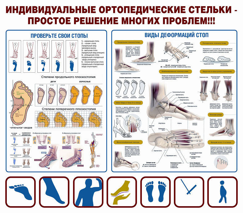 Плакат степени плоскостопия и строение стопы 1050х1200 мм
Плакат степени плоскостопия и строение стопы 1050х1200 мм