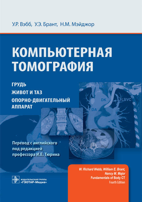 Вэбб У.Р., Брант У.Э., Компьютерная томография. Грудь, живот и таз, опорно-двигательный аппарат 2021 год
Вэбб У.Р., Брант У.Э., Компьютерная томография. Грудь, живот и таз, опорно-двигательный аппарат 2021 год