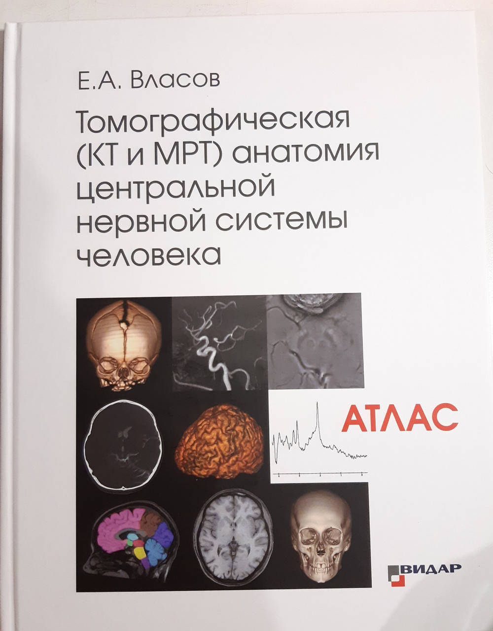 Власов Е.А. Томографическая КТ и МРТ анатомия центральной нервной системы человека Атлас 2020 год
Власов Е.А. Томографическая КТ и МРТ анатомия центральной нервной системы человека Атлас 2020 год