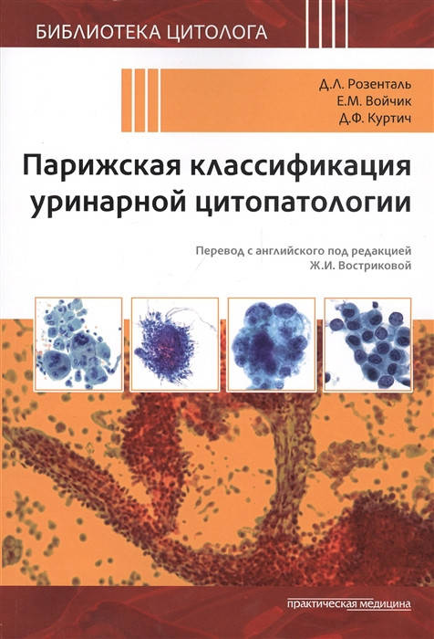 Розенталь Д., Войчик Е., Куртич Д. Парижская классификация уринарной цитопатологии 2020 год
Розенталь Д., Войчик Е., Куртич Д. Парижская классификация уринарной цитопатологии 2020 год