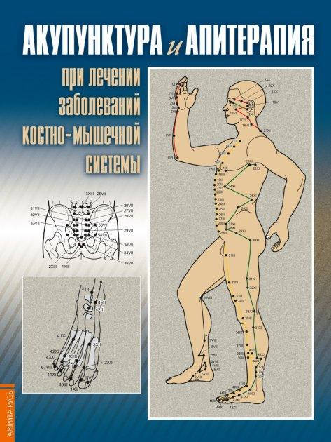 

Акупунктура и Апитерапия при лечении заболеваний костно-мышечной системы