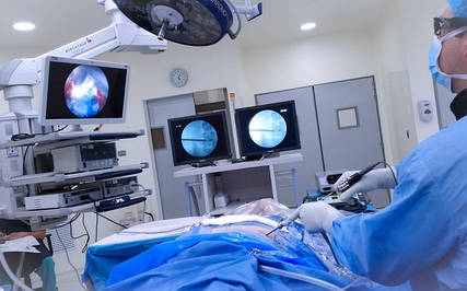 Ендоскопічне обладнання