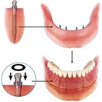 Храповий Ключ MDI IMTEC