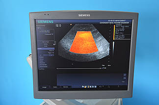 УЗД апарат Siemens Antares ACUSON Premium Edition, фото 6