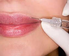 Контурна пластика