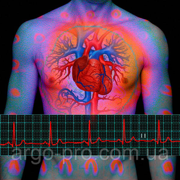 Гіпертонічна хвороба, регуляція тиску, для серця, судин, атеросклероз Колоїдні фітоформули Арго