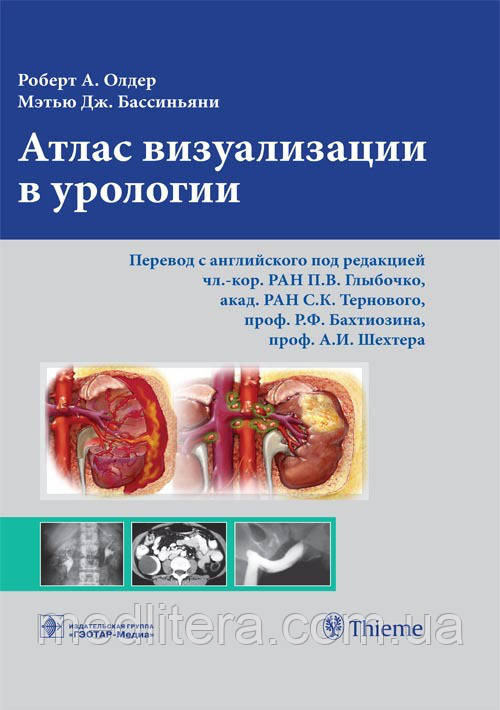 Олдер А. Р., Бассиньяни М. Дж. Атлас візуалізації в урології, фото 1
