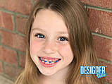 Дизайнерська еластична лігатура 10 шт. на модулі DesignerTies® (G&H Orthodontics) США, без латексу, фото 5