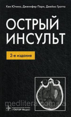 Ючино Кен, Парі Дженіфер, Гротта Джеймс Гострий інсульт
