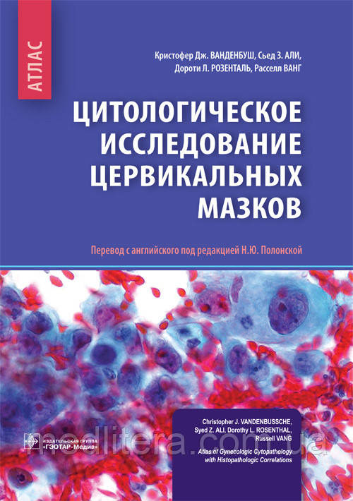 Ванденбуш К. Дж. Цитологічне дослідження цервікальних мазків. Атлас. 2018 рік