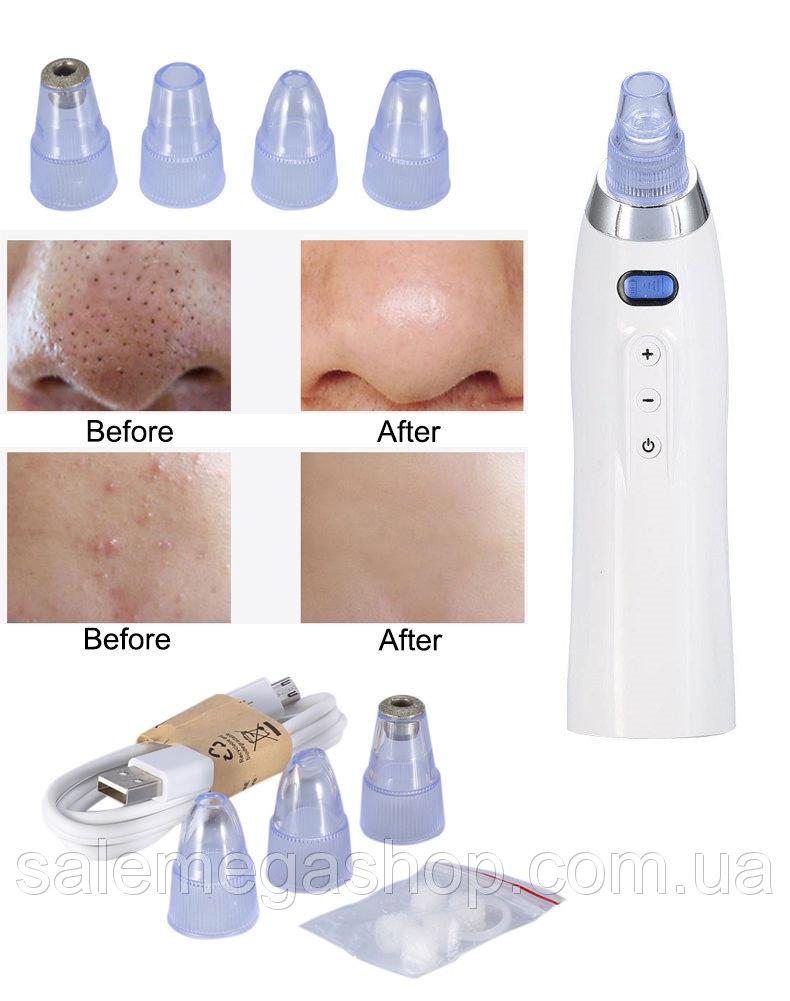 Вакуумне очищення обличчя Comedo Suction 4 насадки, фото 1