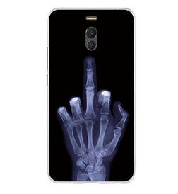 Чохол панель силіконова накладка для Meizu M6 Note з картинкою рентген руки