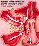 Спрей у разі гаймориту Вековий Схід, фото 4