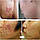 Крем-гель No1 від рубців, шрамів, слідів від прищів і укусів комах LANBENA, фото 5