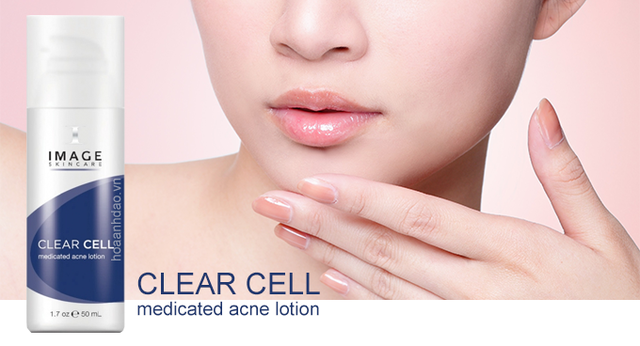 Баннер Acne Lotion