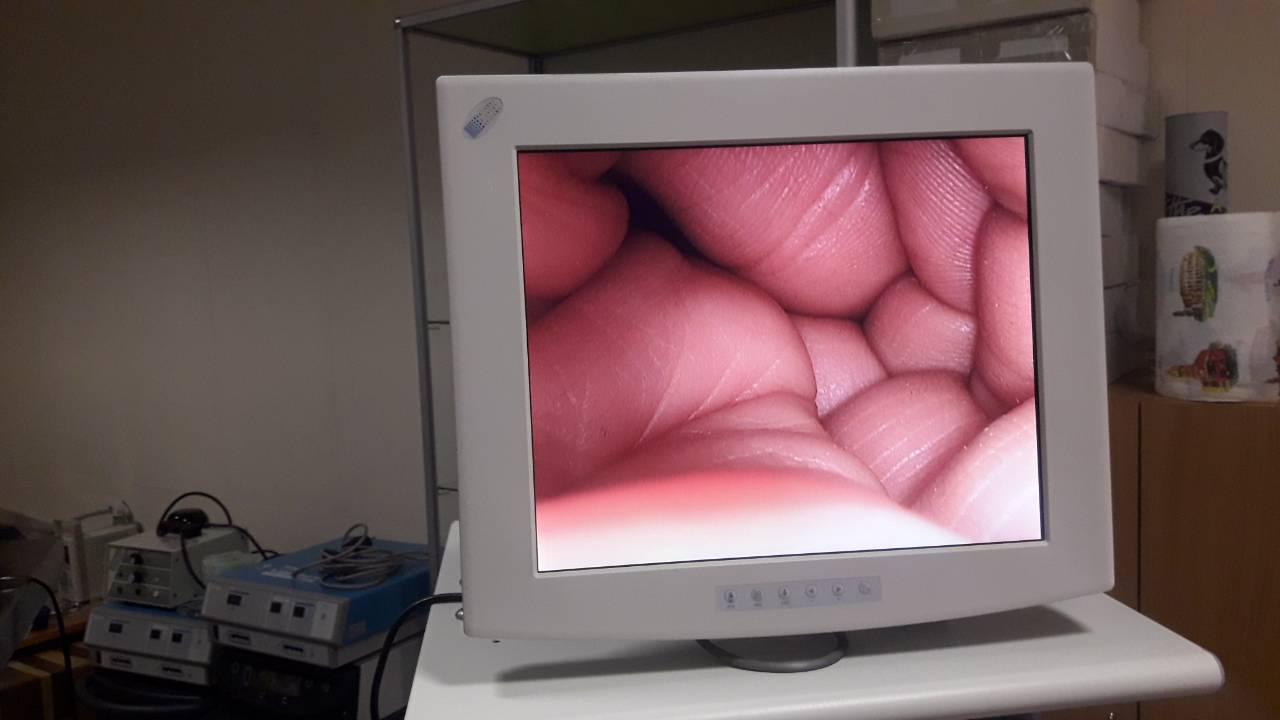 Медичний монітор NDS 18 дюймів