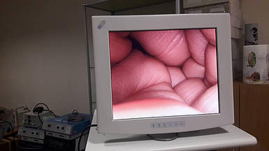 Медичний монітор NDS 18 дюймів