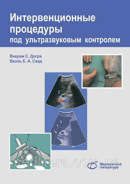 Догра В. С. Інтервенційні процедури під ультразвуковим контролем