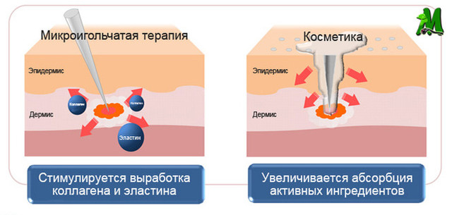 Мезороллер для кожи Skin Roller System 540 0,5 мм 