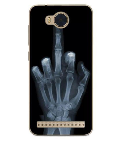 Бампер для Huawei Y3ii з малюнком рентген руки