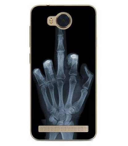 Бампер для Huawei Y3ii з малюнком рентген руки, фото 1