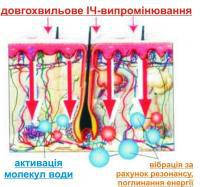Влияние инфракрасного излучения на здоровье