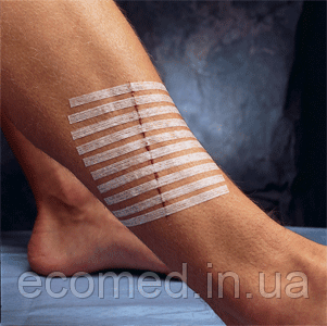 СТЕРІ-СТРІП стрічки для безшовного закриття ран 6мм*75мм,, фото 1