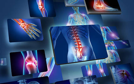 Ортопедичне обладнання