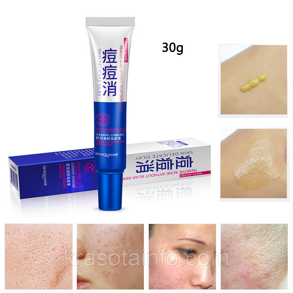 Крем-лікування акне і запалень, прищів, вугрів, acne cream bioaqua