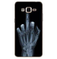 Панель силіконова накладка для Samsung Galaxy J2 prime G532f з малюнком рентген руки