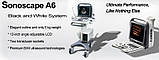 Апарат УЗД Sonoscape A6 ультразвукова діагностична система, фото 3