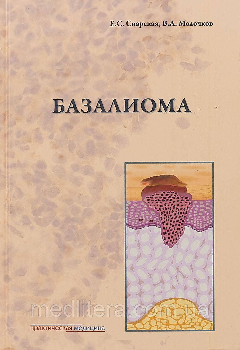 Снарська Е. С., Молочков Ст. А. Базаліома, фото 1