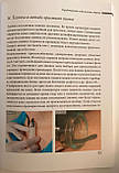 Книга з гірудотерапії гірудотерапевта Куплівської Лідії, фото 5