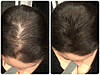 Кератинові мікроволокна для волосся Toppik (Топік) 12 г Чорний, фото 6