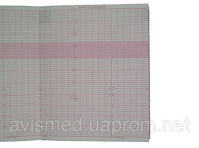 Термопапір для фетального монітора MFM-2 Cadence