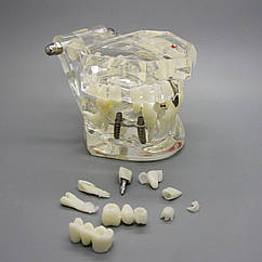 Демонстраційні моделі зубів