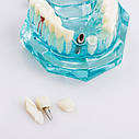 Модель верхньої й нижньої щелеп для стоматологів, фото 6