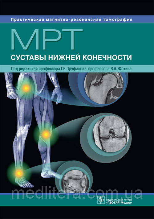 Труфанов Г.Е. МРТ. Суглоби нижньої кінцівки Посібник по МРТ