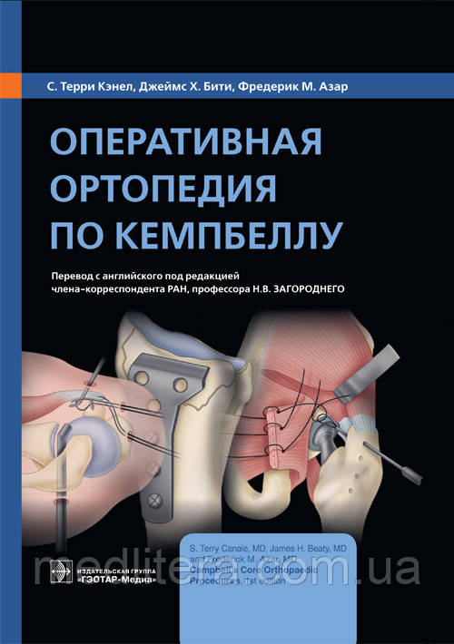 Кэнел С. Т., Біті Дж.Х., Азар Ф. М. Оперативна ортопедія за Кемпбеллу 2021 рік